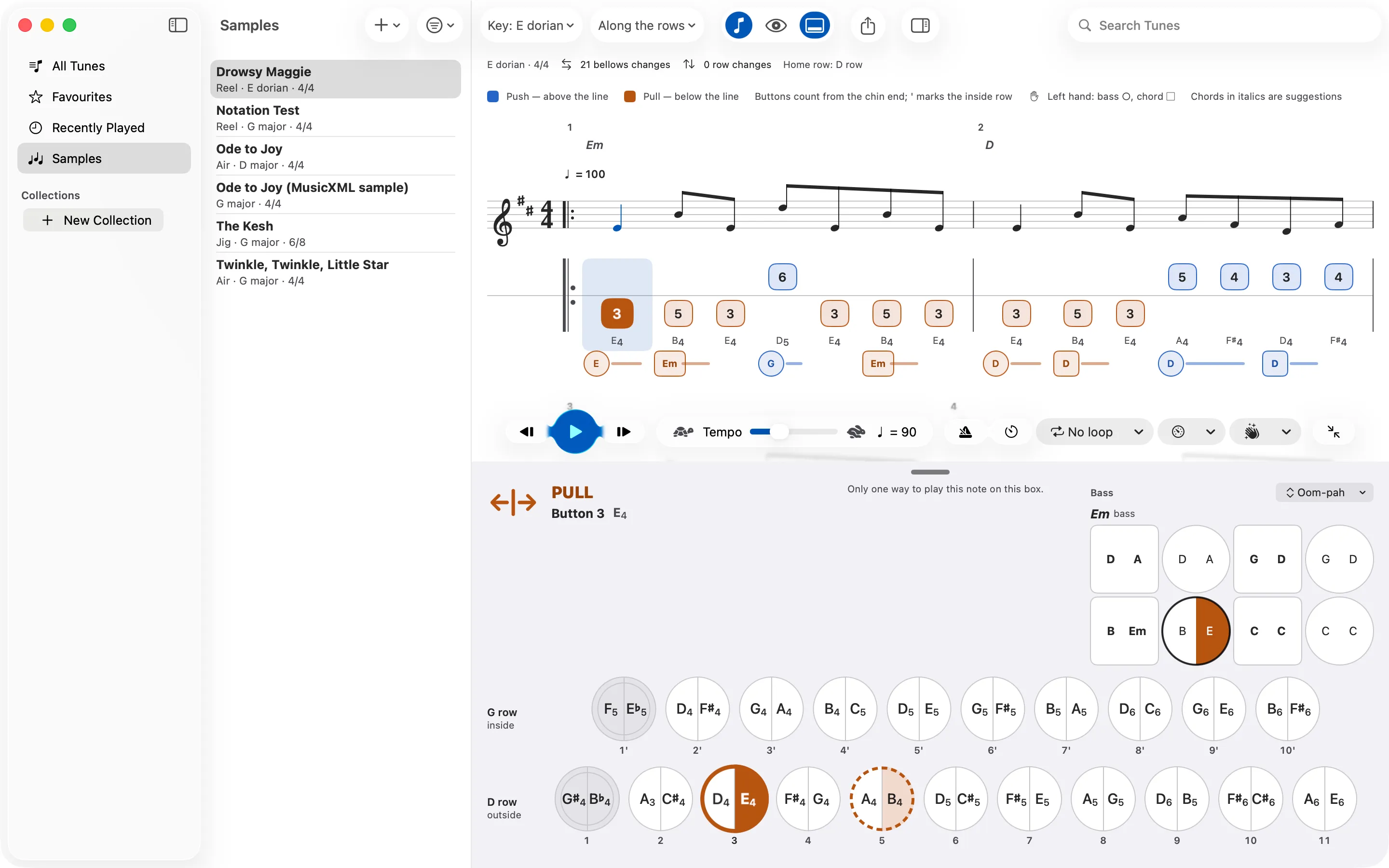 Staff notation above the tab, each note lined up with its button